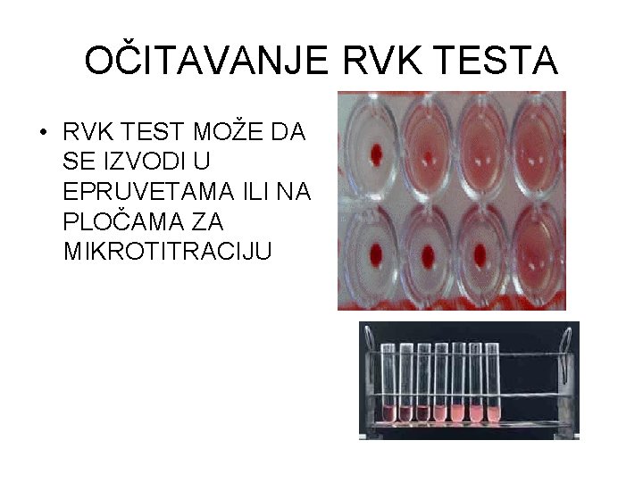 OČITAVANJE RVK TESTA • RVK TEST MOŽE DA SE IZVODI U EPRUVETAMA ILI NA