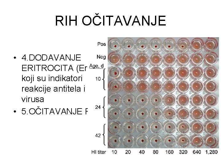 RIH OČITAVANJE • 4. DODAVANJE ERITROCITA (Er) koji su indikatori reakcije antitela i virusa