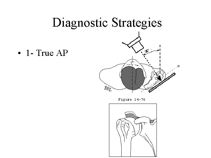 Diagnostic Strategies • 1 - True AP 