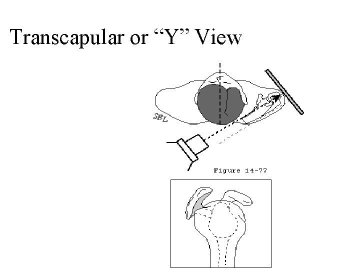 Transcapular or “Y” View 