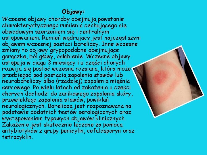 Objawy: Wczesne objawy choroby obejmują powstanie charakterystycznego rumienia cechującego się obwodowym szerzeniem się i Objawy: Wczesne objawy choroby obejmują powstanie charakterystycznego rumienia cechującego się obwodowym szerzeniem się i