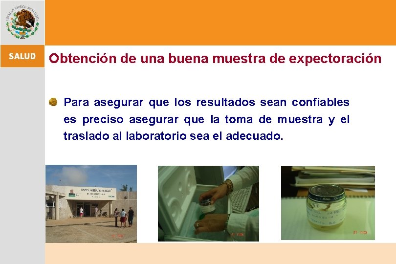 Obtención de una buena muestra de expectoración Para asegurar que los resultados sean confiables