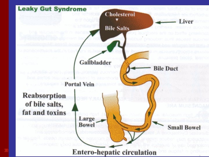 Leaky Gut Syndrome 38 