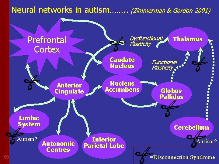 Neural networks in autism……. . (Zimmerman & Gordon 2001) Prefrontal Cortex Dysfunctional Plasticity Caudate