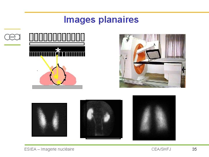 Images planaires * ** ESIEA – Imagerie nucléaire CEA/SHFJ 35 