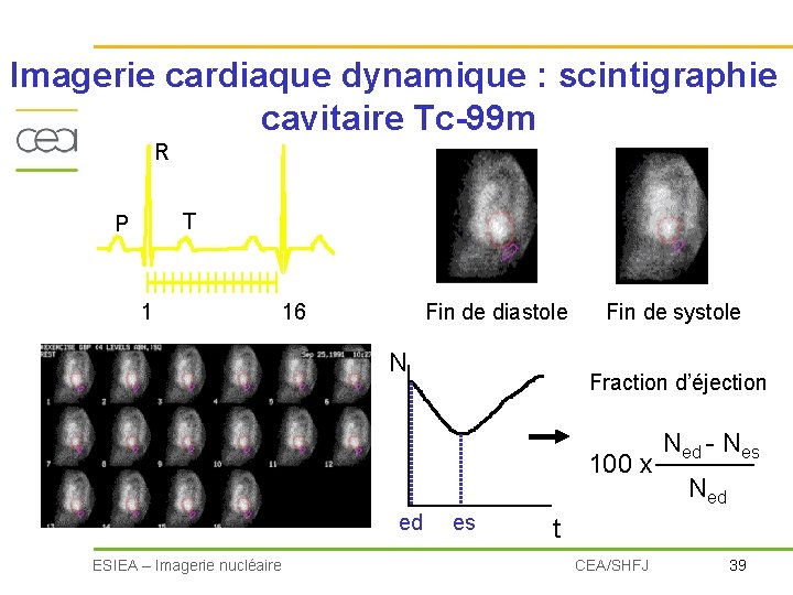Imagerie cardiaque dynamique : scintigraphie cavitaire Tc-99 m R P T 1 16 Fin