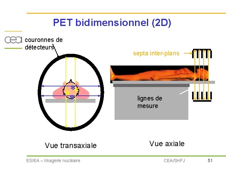 PET bidimensionnel (2 D) couronnes de détecteurs septa inter-plans * *** Vue transaxiale ESIEA