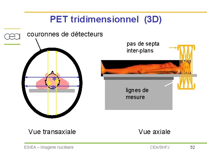 PET tridimensionnel (3 D) couronnes de détecteurs pas de septa inter-plans **** Vue transaxiale