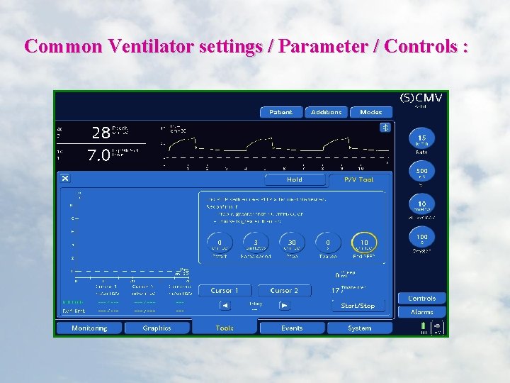 Common Ventilator settings / Parameter / Controls : 