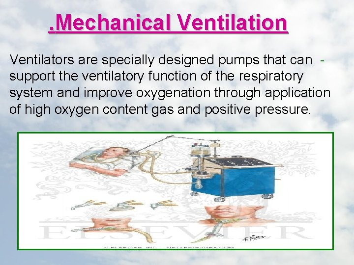 . Mechanical Ventilation Ventilators are specially designed pumps that can support the ventilatory function