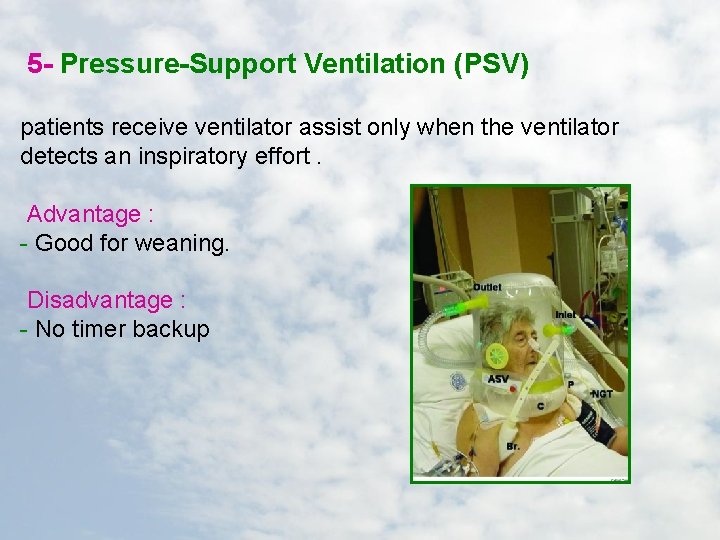 5 - Pressure-Support Ventilation (PSV) patients receive ventilator assist only when the ventilator detects