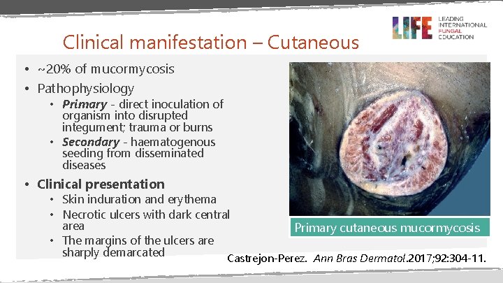 Clinical manifestation – Cutaneous • ~20% of mucormycosis • Pathophysiology • Primary - direct