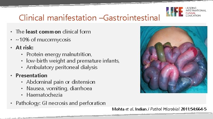 Clinical manifestation –Gastrointestinal • The least common clinical form • ~10% of mucormycosis •