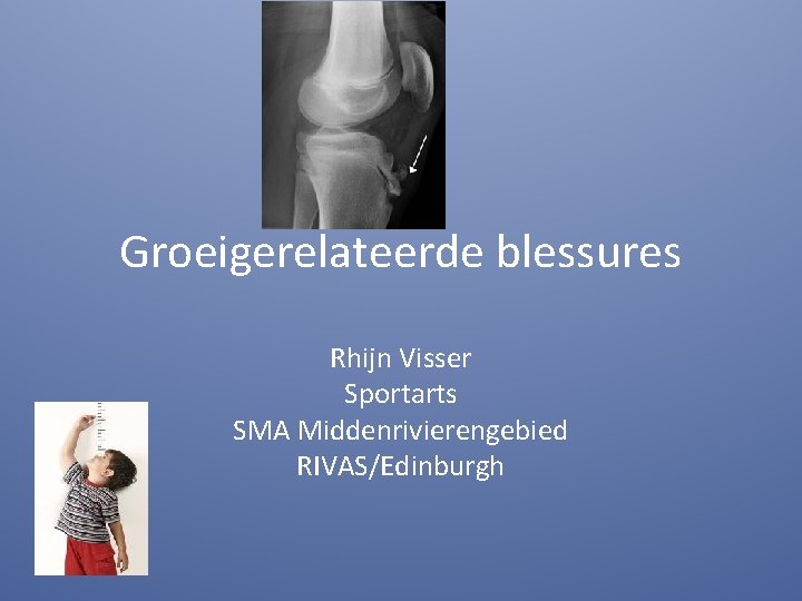 Groeigerelateerde blessures Rhijn Visser Sportarts SMA Middenrivierengebied RIVAS/Edinburgh 