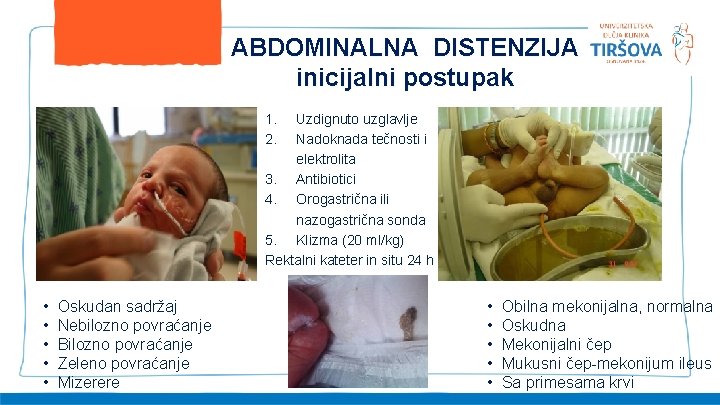 ABDOMINALNA DISTENZIJA inicijalni postupak 1. 2. Uzdignuto uzglavlje Nadoknada tečnosti i elektrolita 3. Antibiotici