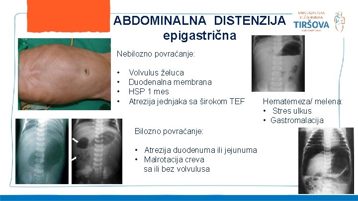 ABDOMINALNA DISTENZIJA epigastrična Nebilozno povraćanje: • • Volvulus želuca Duodenalna membrana HSP 1 mes