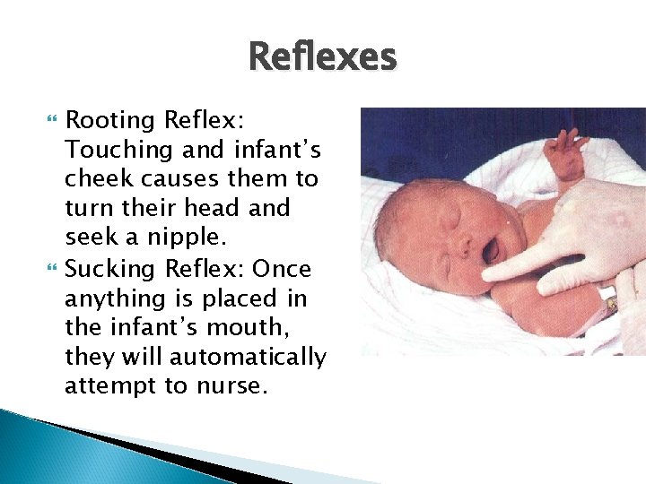 Reflexes Rooting Reflex: Touching and infant’s cheek causes them to turn their head and