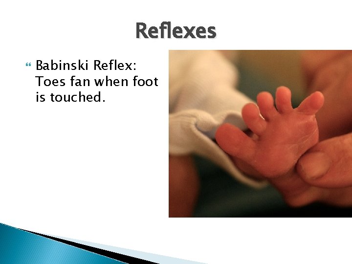 Reflexes Babinski Reflex: Toes fan when foot is touched. 