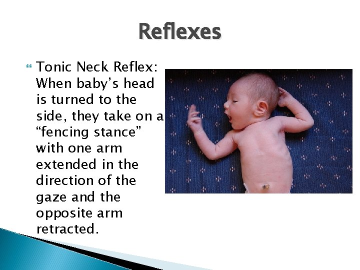 Reflexes Tonic Neck Reflex: When baby’s head is turned to the side, they take