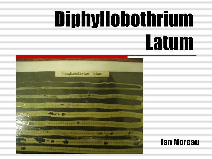Diphyllobothrium Latum Ian Moreau 