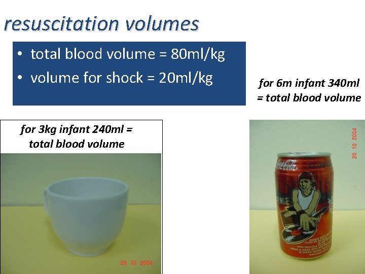 resuscitation volumes • total blood volume = 80 ml/kg • volume for shock =