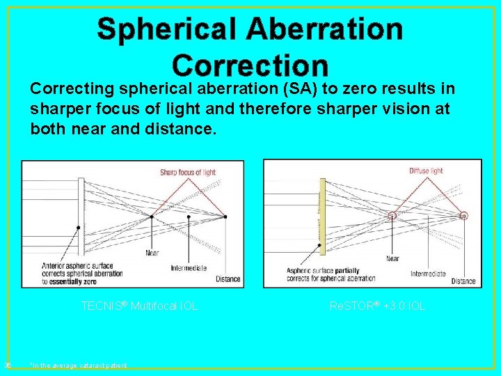 Spherical Aberration Correcting spherical aberration (SA) to zero results in sharper focus of light