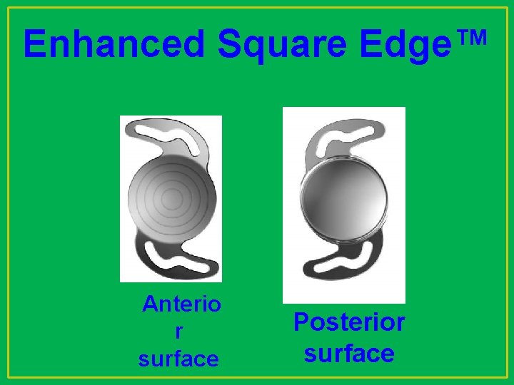 Enhanced Square Edge™ Anterio r surface Posterior surface 