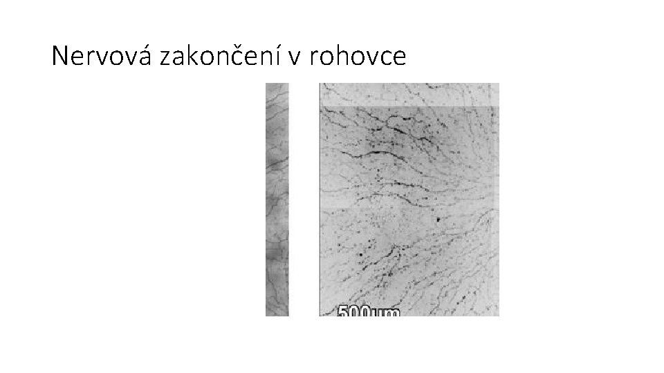 Nervová zakončení v rohovce 