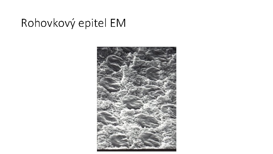 Rohovkový epitel EM 