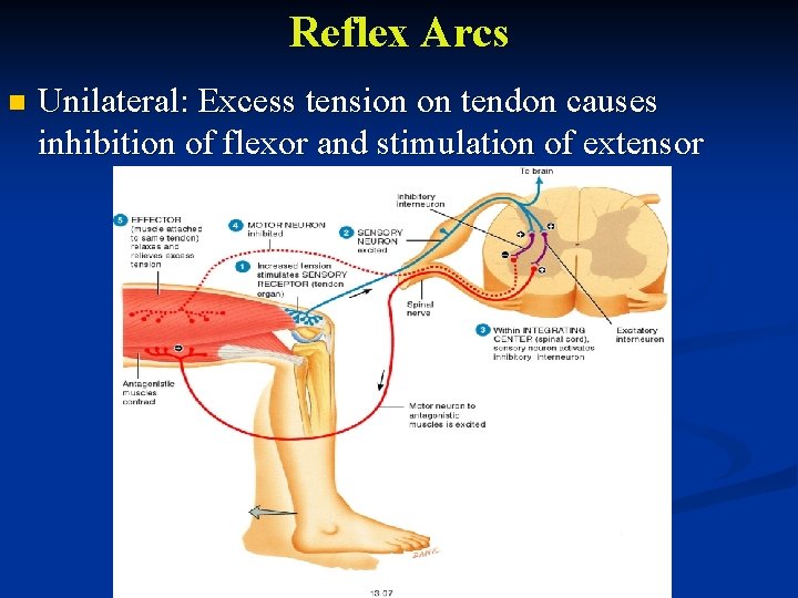 Reflex Arcs n Unilateral: Excess tension on tendon causes inhibition of flexor and stimulation