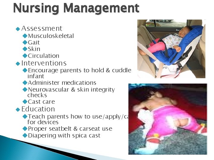 Nursing Management Assessment Musculoskeletal Gait Skin Circulation Interventions Encourage parents to hold & cuddle