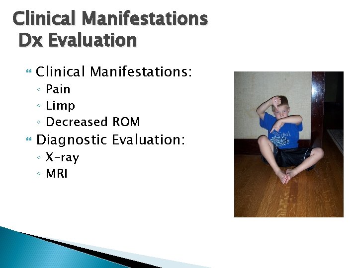 Clinical Manifestations Dx Evaluation Clinical Manifestations: ◦ Pain ◦ Limp ◦ Decreased ROM Diagnostic
