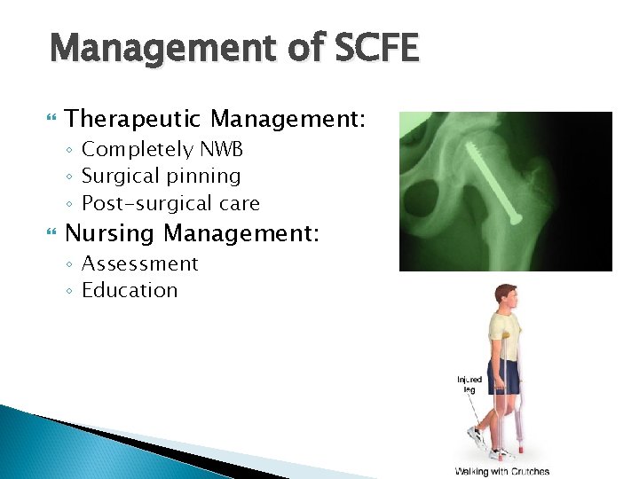 Management of SCFE Therapeutic Management: ◦ Completely NWB ◦ Surgical pinning ◦ Post-surgical care