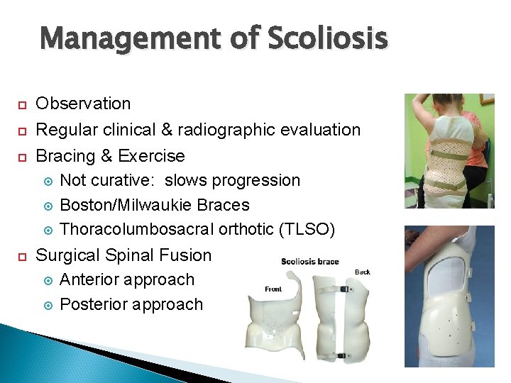 Management of Scoliosis Observation Regular clinical & radiographic evaluation Bracing & Exercise Not curative: