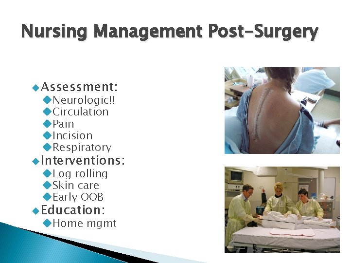 Nursing Management Post-Surgery Assessment: Neurologic!! Circulation Pain Incision Respiratory Interventions: Log rolling Skin care