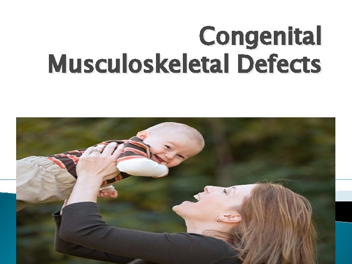 Congenital Musculoskeletal Defects 