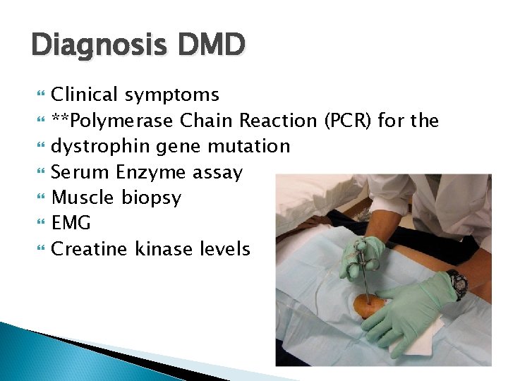 Diagnosis DMD Clinical symptoms **Polymerase Chain Reaction (PCR) for the dystrophin gene mutation Serum