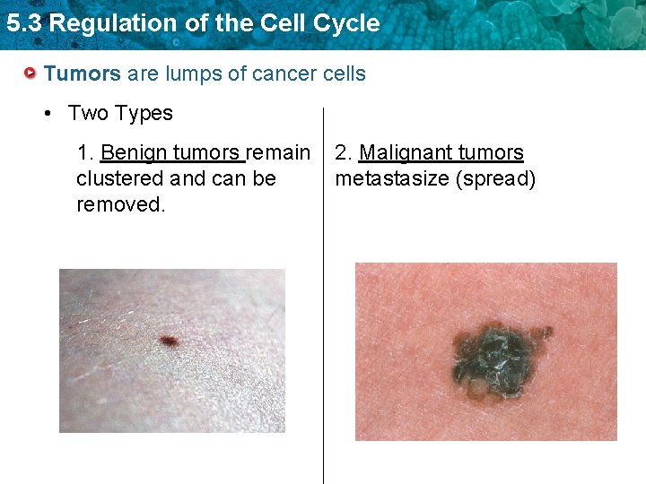 5. 3 Regulation of the Cell Cycle Tumors are lumps of cancer cells •