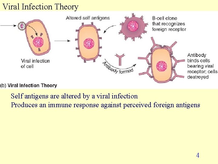 Viral Infection Theory Self antigens are altered by a viral infection Produces an immune Viral Infection Theory Self antigens are altered by a viral infection Produces an immune