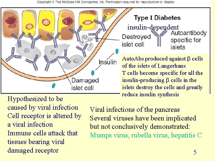 insulin-dependent Hypothesized to be caused by viral infection Cell receptor is altered by a insulin-dependent Hypothesized to be caused by viral infection Cell receptor is altered by a