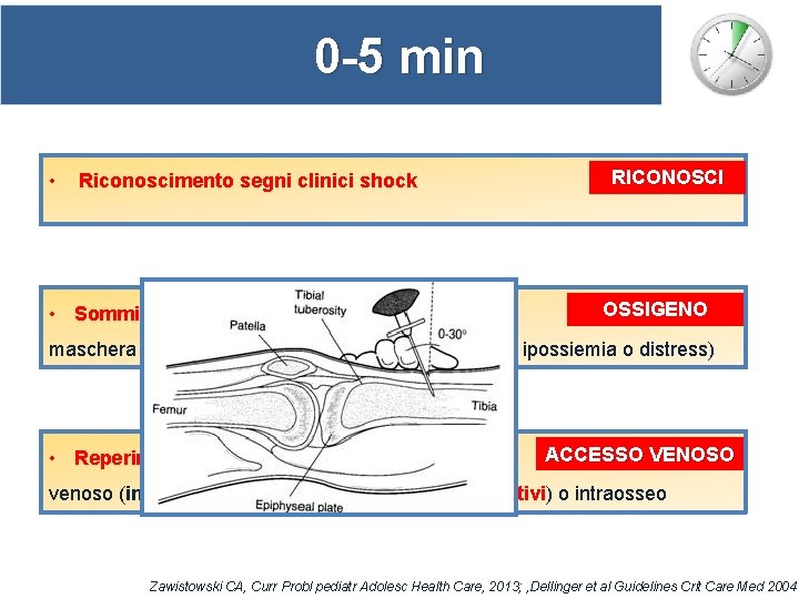 0 -5 min • Riconoscimento segni clinici shock • Somministrazione ossigeno: RICONOSCI OSSIGENO maschera