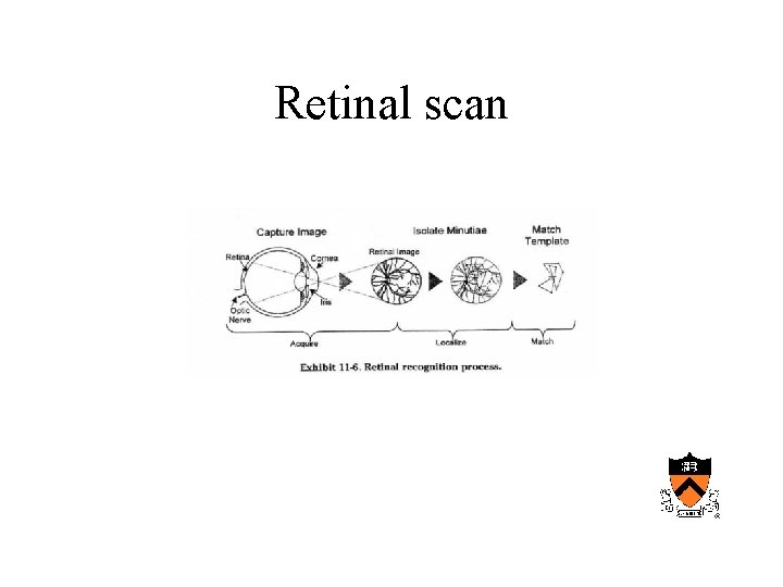 Retinal scan 