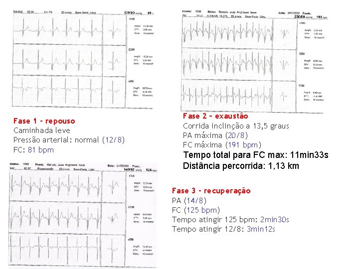 Fase 1 - repouso Caminhada leve Pressão arterial: normal (12/8) FC: 81 bpm Fase