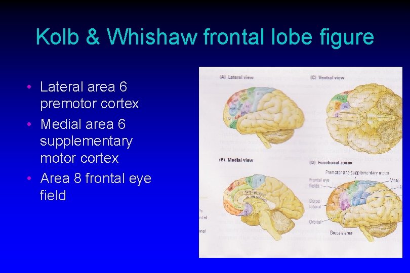 Kolb & Whishaw frontal lobe figure • Lateral area 6 premotor cortex • Medial