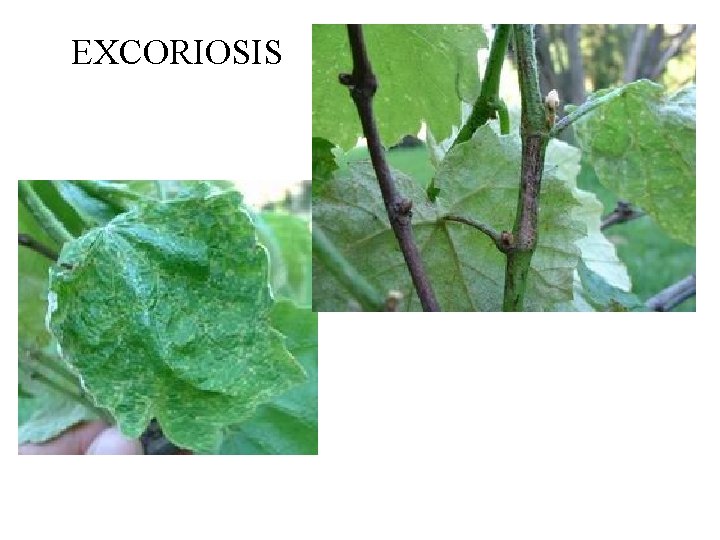 EXCORIOSIS 