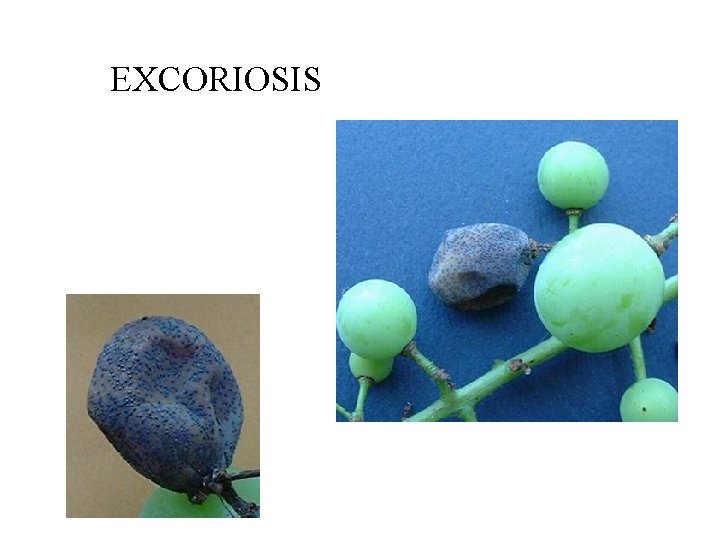 EXCORIOSIS 