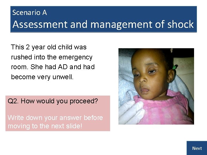 Scenario A Assessment and management of shock This 2 year old child was rushed