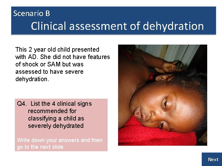 Scenario B Clinical assessment of dehydration This 2 year old child presented with AD.