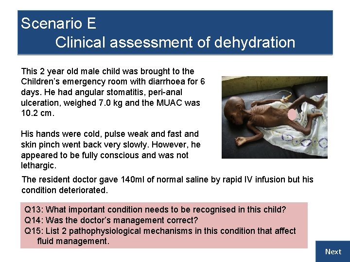 Scenario E Clinical assessment of dehydration This 2 year old male child was brought