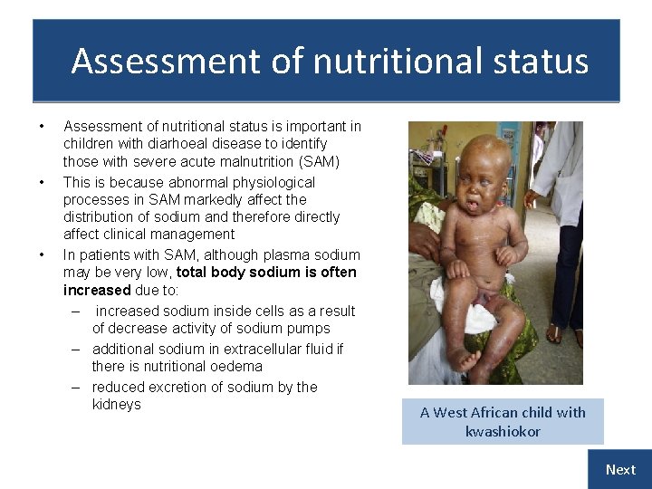 Assessment of nutritional status • • • Assessment of nutritional status is important in